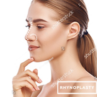 Rhinoplasty