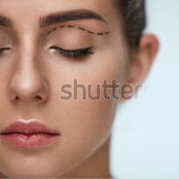 Eyelid Lift