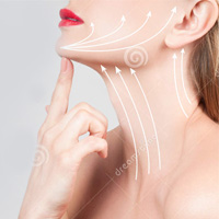 Neck Lift